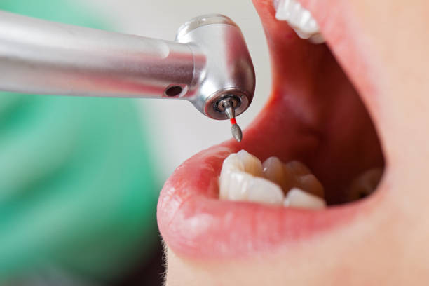 Best Knocked-Out Tooth Emergency  in Edgar, WI